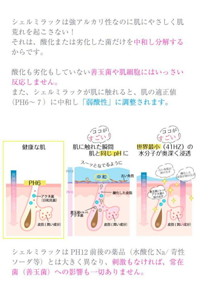 シェルミラック スキンコンディショナー 1000ml 小鼻 黒ずみ 鼻 黒ずみ