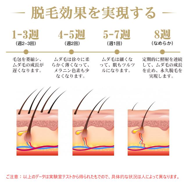 脱毛器 IPL脱毛器 光美容器 ヒゲ ムダ毛処理 全身脱毛 5段階照射レベル コラーゲン活性化 美肌効果 99万発照射 ビキニライン脱毛_5