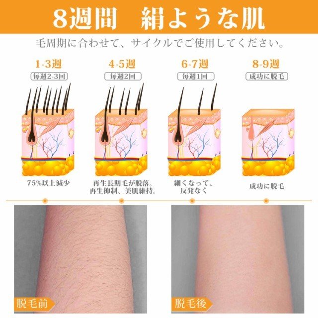 IPL光脱毛器 光美容器　冷却機能 永久脱毛 99万回照射 5階段 メンズ レディース 髭 脇 全身脱毛　小型 家庭用 男女兼用 メンズ レディース 日本語説明書付き_6