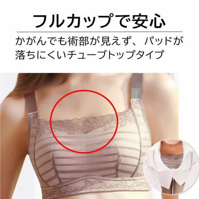 図で理解する乳癌手術の実際