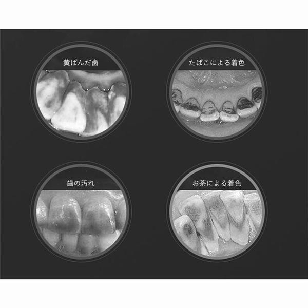 実力派 口腔洗浄器 電動歯ブラシ 口腔洗浄機 歯石取り 器具 口腔ケア美容器 超音波 生活級防水 五つのモード LED照明 歯石、黄ばみ、汚れ、歯石を解決、歯をきれいにする 口臭防止 歯周病予防 電動はぶらし 充電式 歯石除去 贈り物や自分用に 家庭用 恋人に 両親に