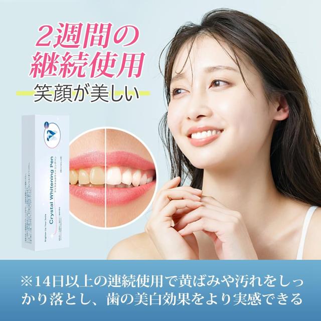 ホワイトニング V34 歯磨き 歯を白く ホワイトニングジェル 程よかっ  