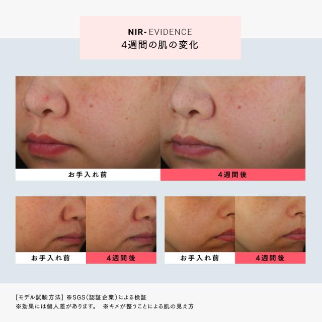 MYTREX MiRAY 専用NIRリフトアタッチメント Near infrared 近赤外線