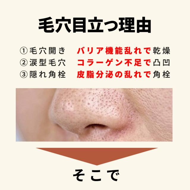 【送料無料】【毛穴対策セット】 クリスタルローション アンレアセラム ピュアエッセンス 毛穴目立たなく 毛穴美容液 毛穴 毛穴ケア 美容液毛穴 角栓 角栓取り 角栓ケア 鼻角栓 小鼻毛穴角栓黒ずみケア 角質ケア 角質除去 角質ケア顔洗顔 美肌 ゴワツキ 黒ず_1