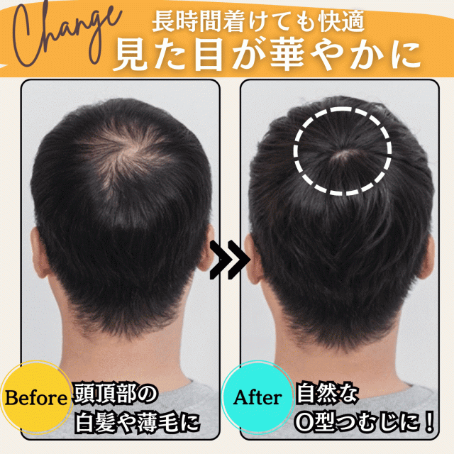 新品ウィッグ 薄毛カバー グレー80% ウィッグ 部分かつら 人毛