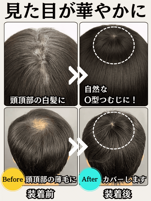 部分ウィッグ ヘアピース 人毛100% トップカバー 増毛かつら トップウィッグ カバーピース ポイントピース トップピース かつら 男性 女性 ウイッグ メンズ レディース 形脱毛 つむじ 頭頂部 薄毛 脱毛 人毛 ショート 両面テープ付 自然 Luce brillare ルスブリラーレ_3