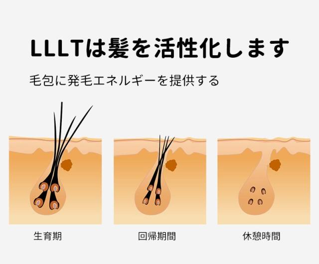育毛キャップ 　赤色 led 育毛　育毛システム81個 育毛 ヘルメット 治療ライト 脱毛 薄毛治療 男女共用 副作用のないヘ髪の再生 超軽量 操作簡単 安全装置搭載 USB給電式　頭皮_4