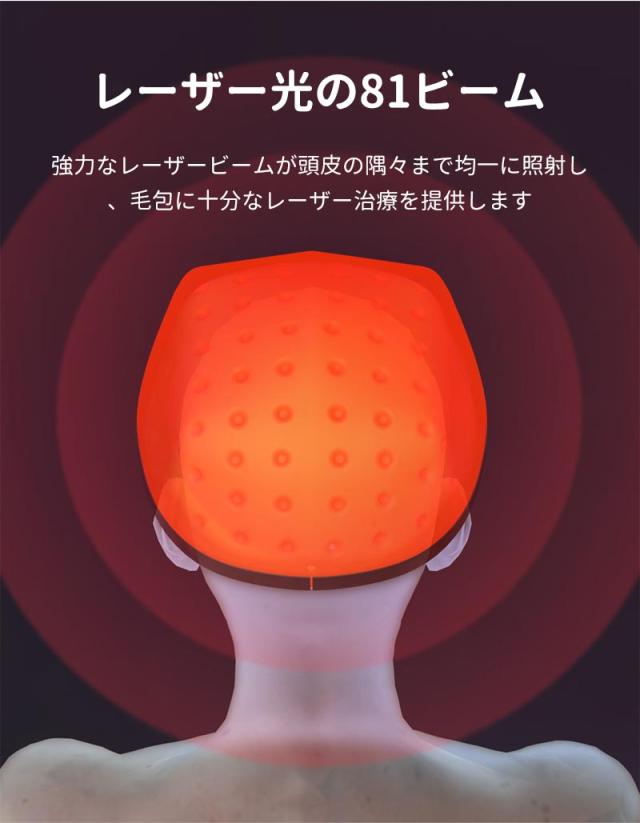 育毛キャップ 　赤色 led 育毛　育毛システム81個 育毛 ヘルメット 治療ライト 脱毛 薄毛治療 男女共用 副作用のないヘ髪の再生 超軽量 操作簡単 安全装置搭載 USB給電式　頭皮_7