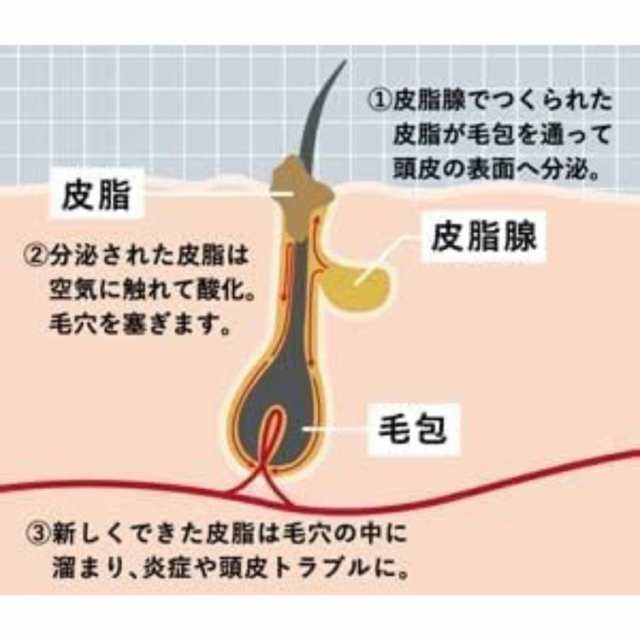 持田ヘルスケア コラージュフルフル スカルプシャンプー 340ml つめかえ用 SCALPの通販はau PAY マーケット くらし応援本舗 au  payマーケット店（くらしドラッグ） au PAY マーケット－通販サイト