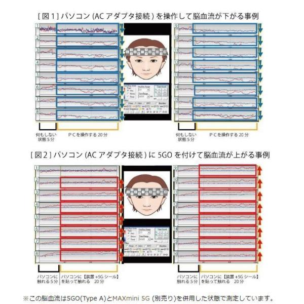【送料無料】5GO Type A （ブラック/ホワイト/ピンク/ブルー）×２個セット ユニカ 電磁波防止 電磁波対策 ユニカ 電磁波防止グッズ 丸山 電磁波カット 電波_6