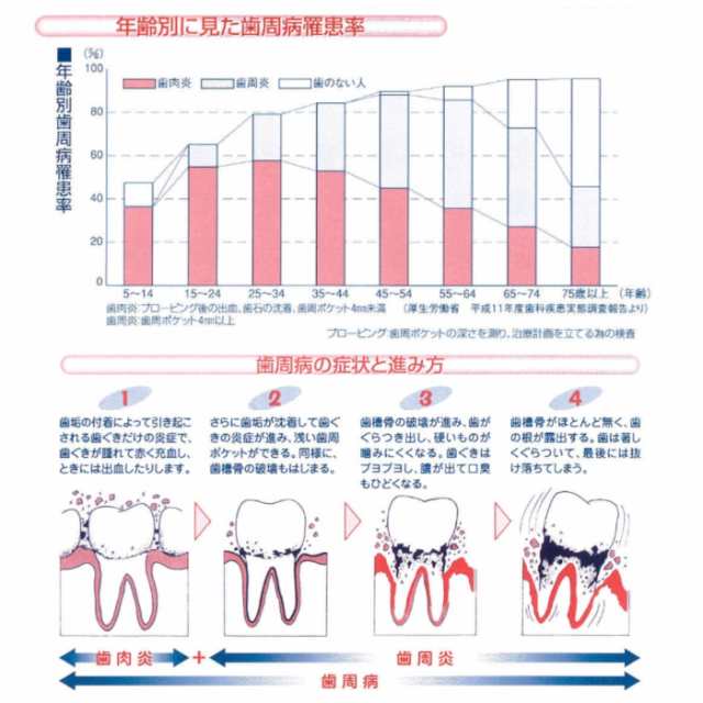 薬用 ソルト ぎょくせい 115g ×6本 SUNSTAR サンスター 歯磨き粉 はみがき 歯周病 歯肉炎 歯周炎 予防 塩化セチルピリジニウム 配合