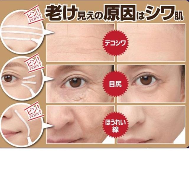 10個セット【薬用シワハールEX 30g】 医薬部外品 オデコ 目尻 ほうれい線 シワ改善 薬用クリーム しわ シワ シミ ケア しわ改善 しわ シワ 消す お肌 しわ しみ_2