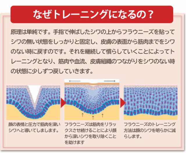 日本正規品 フラウニーズ FROWNIES 額・眉間用 144ピース入り 日本