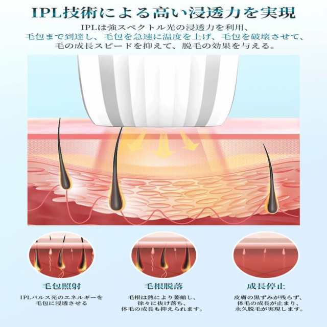 脱毛器 IPL光脱器 永久脱毛 家庭用脱毛器 自動照射 レーザー vio対応 メンズ レディース 脇 腕 足 背中 全身用 LED液晶 全身適用 脱毛器レーザー 脱毛機 男女兼用 プレゼント_7