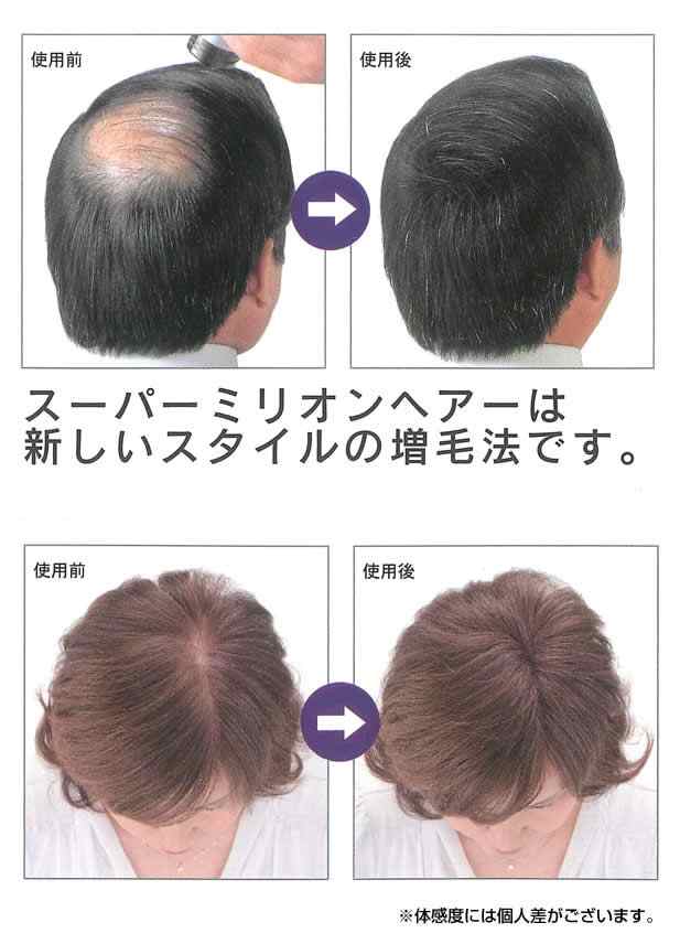 スーパーミリオンヘアー 20g ダークブラウン No.2 ミリオンヘアー 頭皮