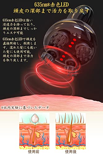 Youmay EMS ヘッドスパ 電動頭皮ブラシ 電気針 赤色LED機能付き