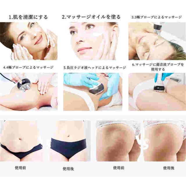 家庭用キャビテーション ラジオ波 1台で4役 4in1 バキューム吸引顔用