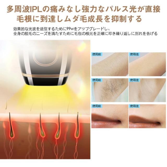 脱毛器 女性 光美容器 vio対応 メンズ 顔 ボディ フェイス ヒゲ 脇 美肌 IPL光脱毛 全身ケア だつもうき脱毛器 無痛 5段階調節 99万回照射 家庭用 送料無料_7