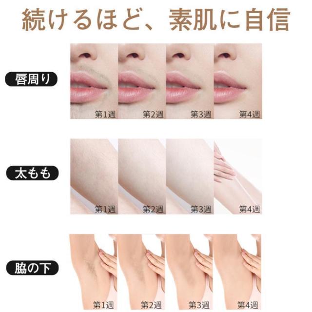 脱毛器 女性 光美容器 vio対応 メンズ 顔 ボディ フェイス ヒゲ 脇 美肌 IPL光脱毛 全身ケア だつもうき脱毛器 無痛 5段階調節 99万回照射 家庭用 送料無料_8