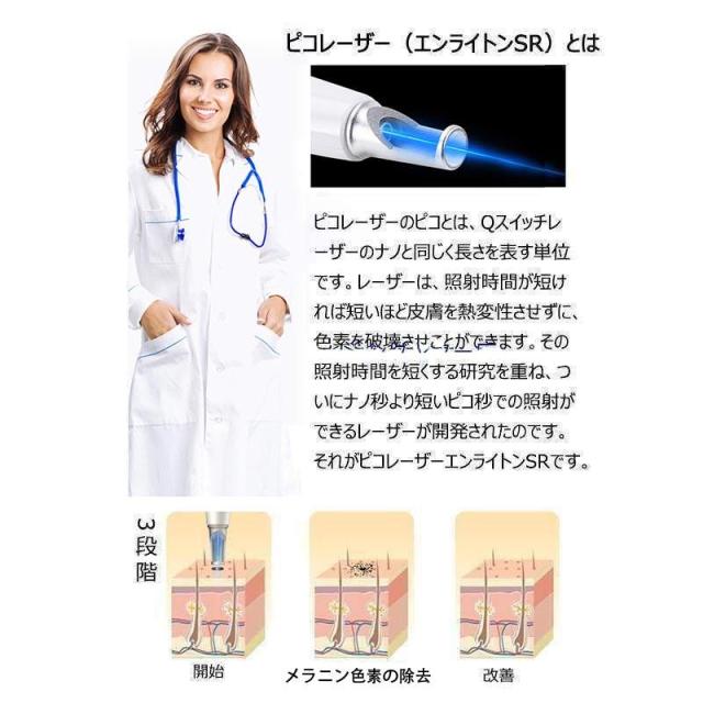 美顔器 ピコレーザー 美顔器 ほくろそばかす除去 シミ 斑 青色