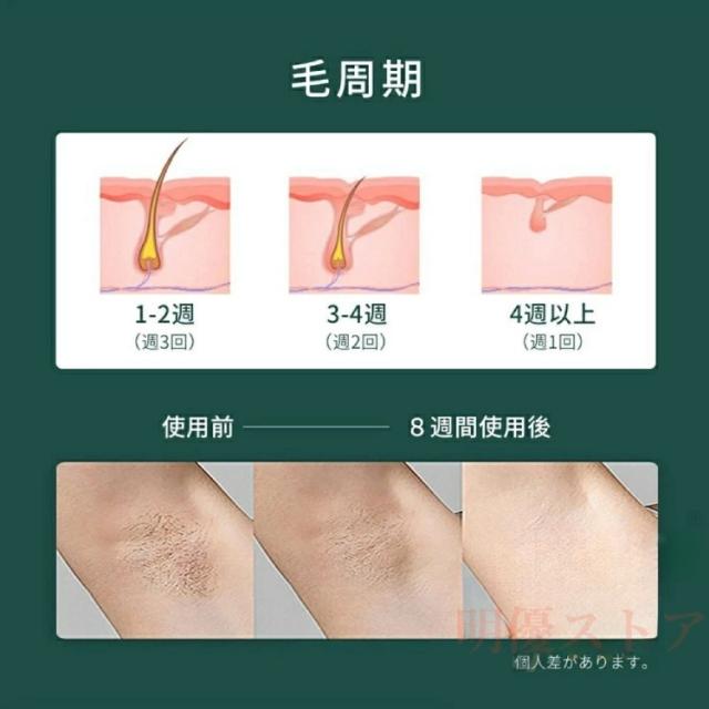脱毛器 vio対応身用 家庭用 全身快速脱毛 除毛 女性 ipl光脱器 無痛脱毛器 脇 腕 足 背中 全身用 快速脱毛 家庭用 全身快速脱毛  家庭用  PSE認証_9