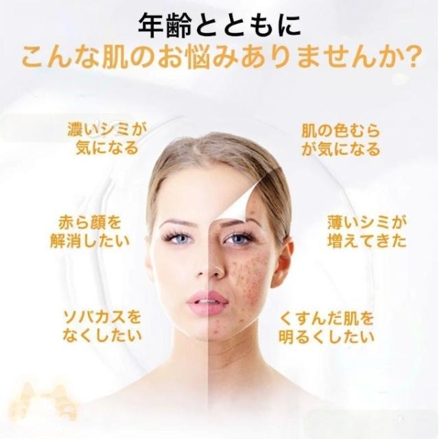 ピコ 美顔器 レーザー 美顔器 ピコレーザー ほくろそばかす除去 シミ 斑 青色レーザー