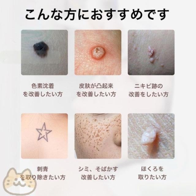 ピコ 美顔器 レーザー 美顔器 ピコレーザー ほくろそばかす除去 シミ 斑 青色レーザー