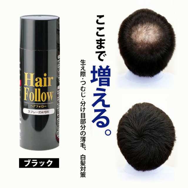 増毛スプレー ヘアフォロー 150g ブラック A-03 ｜ 薄毛隠し 薄毛対策