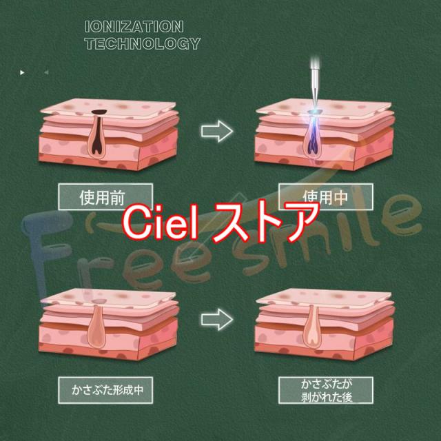 ［新品］特別価格シミケアポレーション　ほくろ、シミ取り　箱潰れ一部あり ペン レーザー除去ペン 美顔器 シミ取り イボ 口コミ シミ