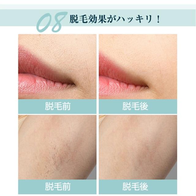 脱毛器 IPL光脱毛器 家庭用 光美容器 美肌機能 交換用カートリッジ付き 5段階調節 手動/自動照射 男女兼用 3つのケアモード 合計60万回照射 液晶表示 保護メガネ付き 肌に優しい_11