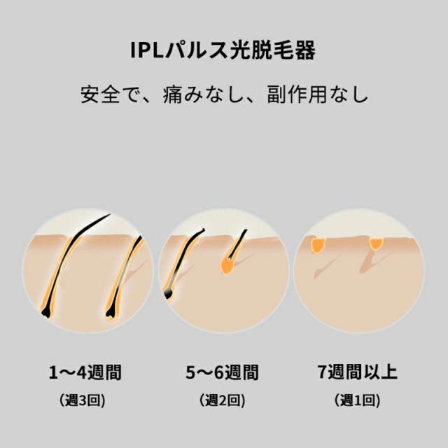 脱毛器 光脱毛器 IPL光 家庭用 男女兼用 全身 安全便利 自宅 IPL 脱毛