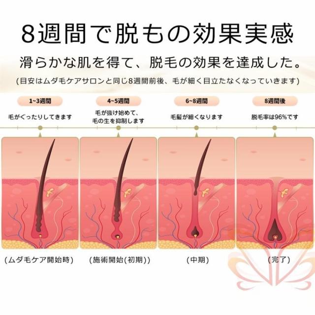 脱毛器 女性 メンズ vio対応 氷点冷感機能 光脱毛器 光美容器 家庭用 100万発照射 5種モード 連続照射 美肌 脱毛器具 全身用 顔 うぶ毛 脇 腕 足 背中_13