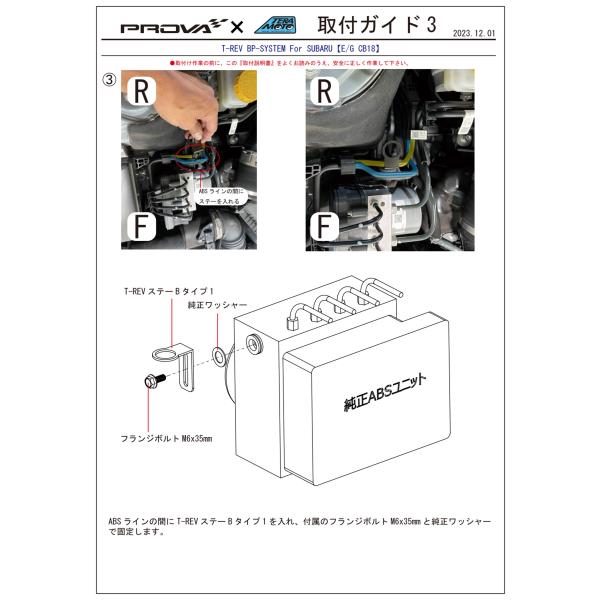 リュータービットセット 87個 プラスチックケース付き リューター