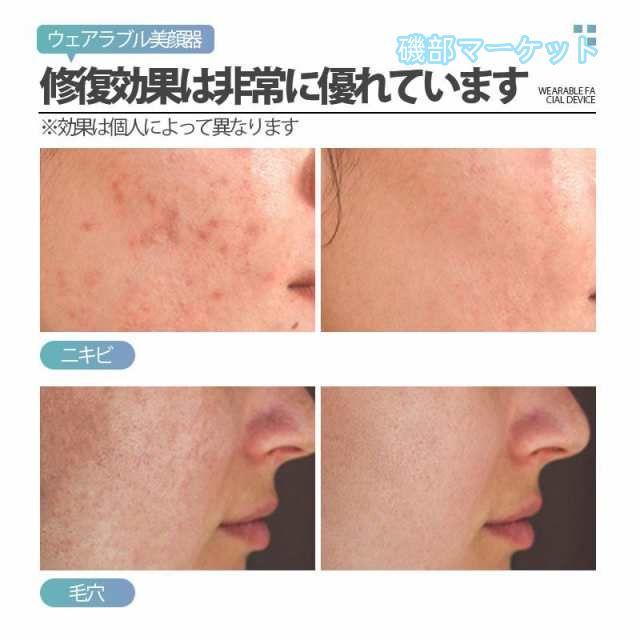 美顔器 最新発売 リフトアップ効果 美容マスク フェイシャルマスク USB