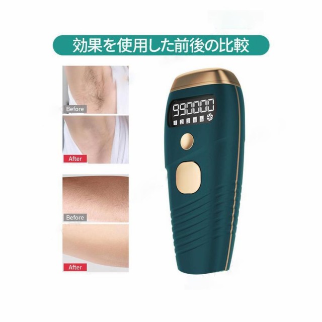 脱毛器 家庭用脱毛 脱毛機 永久 全身適用 氷感 99万発 男女