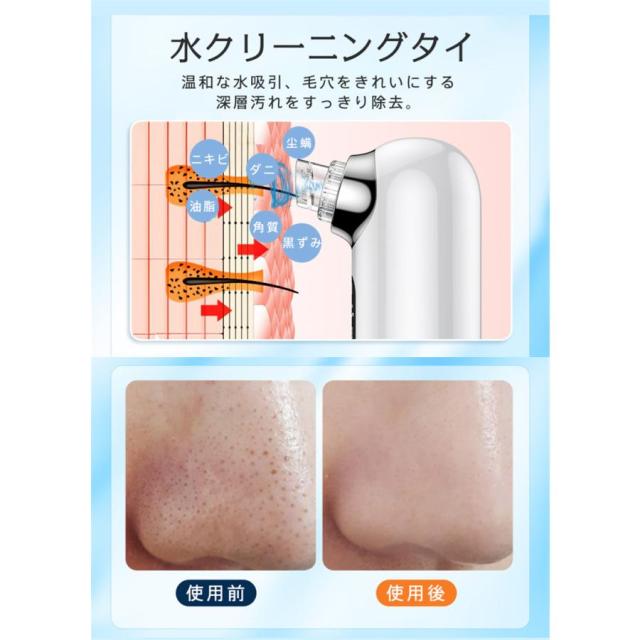 2025新作 毛穴吸引器 美顔器 保湿 毛穴ケア スキンケア 水流式 3段階 毛穴吸引 毛穴クリーン ニキビ吸引 イチゴ鼻吸引 美肌 黒ずみ 角栓除去 真空吸引技術 n1 2025新作 毛穴吸引器 美顔器 保湿 毛穴ケア スキンケア 水流式 3段階