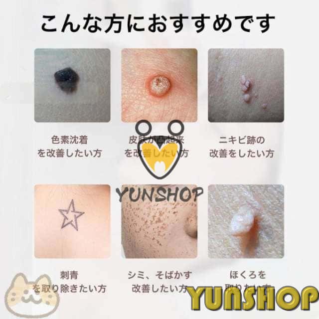 2025 レーザーペン ピコレーザー 美顔器 シミ取り 青色レーザー 赤色