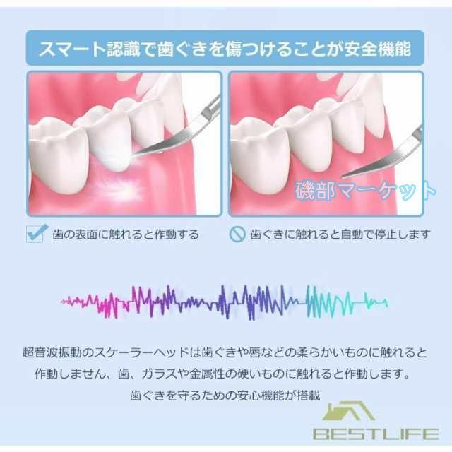 歯石取り 最新発売 超音波口腔洗浄器 内視カメラ搭載 超音波スケーラー