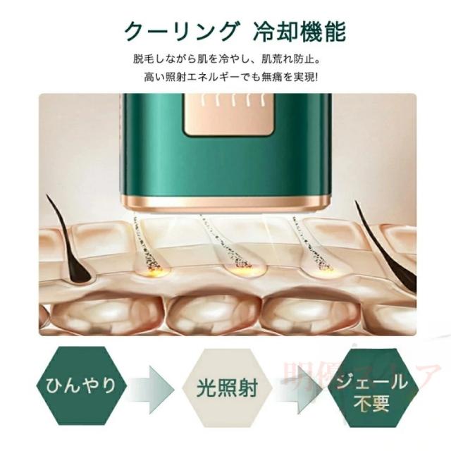 脱毛器 vio対応身用 家庭用 全身快速脱毛 除毛 女性 ipl光