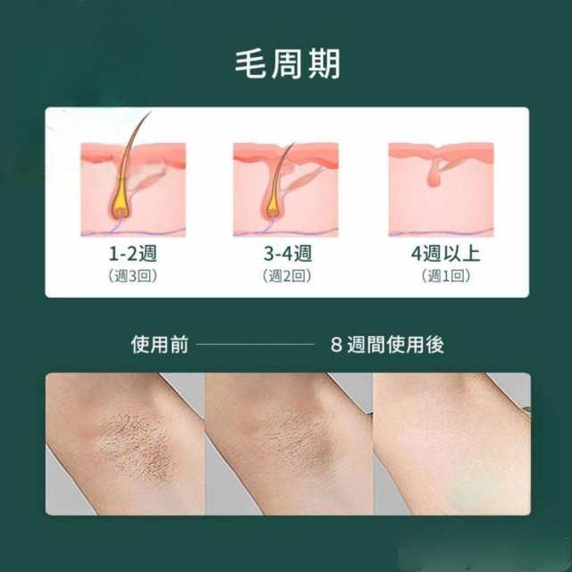 脱毛器 女性 レーザー 家庭用 メンズ ipl光脱器 無痛脱毛器 5段階調節 自動照射 vio対応 脇 腕 足 背中 男女兼用 メンズ レディース 新生活 応援 母の日 2025_14