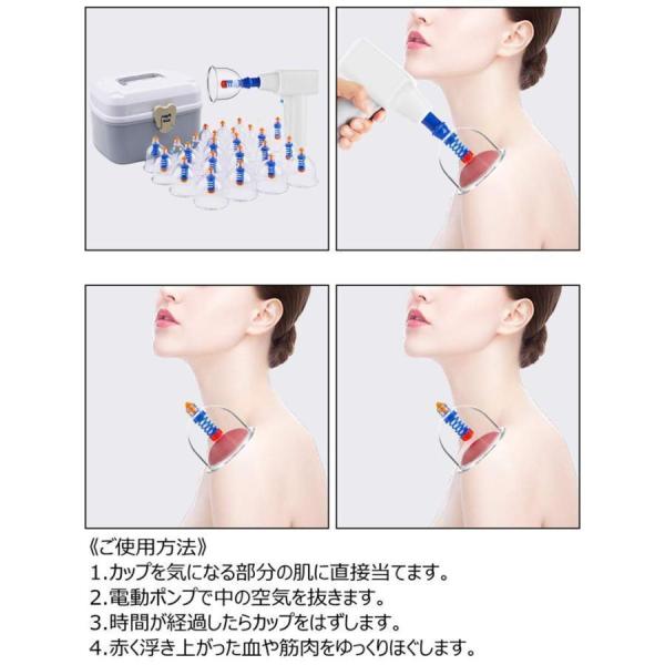 カッピング 吸い玉カッピング 吸玉療法【吸灸】 専用真空ポンプ 24個+6 