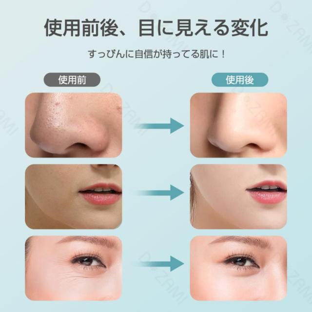 人気ギフト】dozami美顔器 超音波美顔器 1台多役 フェイスケア 目元