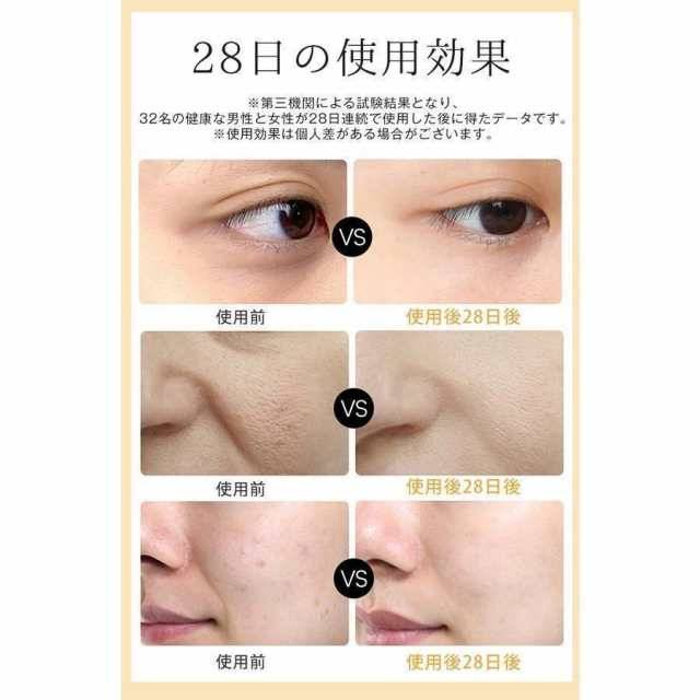 美顔器 リフトアップ効果 EMS 母の日 50代 線フェイスライン 目元使用