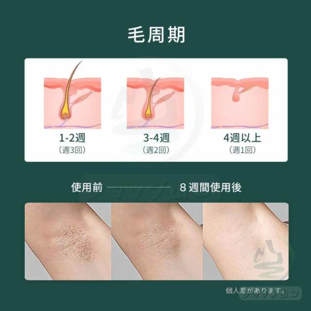 脱毛器 ipl光脱器 無痛脱毛器 脱毛機 サロン級 女性 メンズ 5段階調節 自動照射 レーザー vio対応 メンズ レディース 脇 腕 足 背中 全身用 家庭用 全身快速脱毛 除毛 男女兼用 プレゼント_9