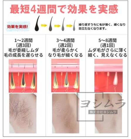 【品質保証】脱毛器 冷感 冷却 脱毛器 vio 光脱毛器 家庭用脱毛器 フラッシュ脱毛器 ipl脱毛器 レーザー脱毛器 顔用 おすすめ 男性 脱毛器 ボディ用脱毛器 おしゃれ デリケートゾーン ムダ毛 高性能 美顔器 ひげ ヒゲ 脚 腕 顔 人気脱毛器_6