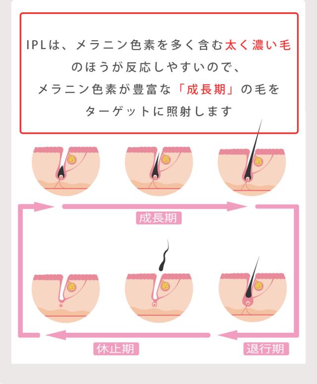 照射回数99万回 冷却 脱毛器 光脱毛器 IPL 脱毛器 家庭用脱毛器 冷感 光エステ ギフト プレゼント フラッシュ 脱毛 光美容器 アンダーヘア 全身 顔 自動照射 【ADORIC BEAUTY 公式】_7
