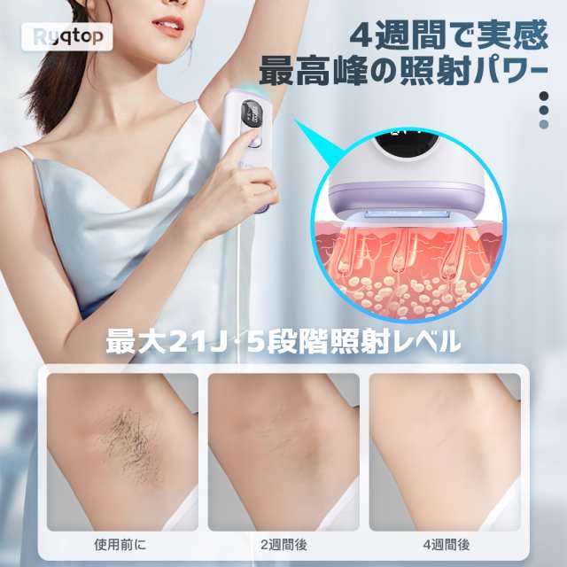 IPL 冷感 脱毛器 光脱毛器 家庭用脱毛器 光 顔 自動照射 99.8万発 5