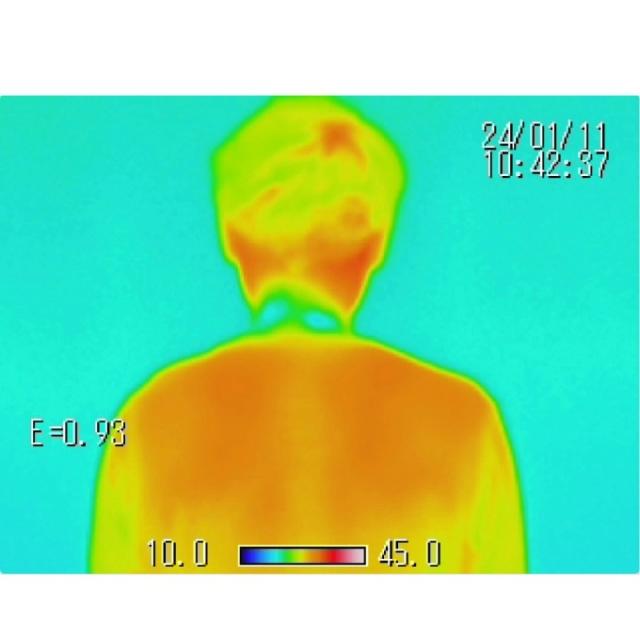 ライト LITE アイシング 巻けるFIT氷のう ふつうサイズ G-575