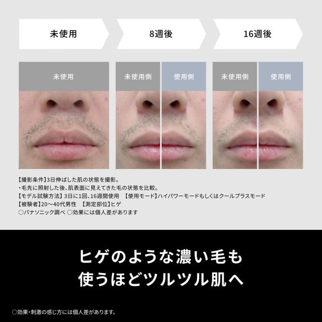 パナソニック 光美容器（グレー） Panasonic 光エステ SMOOTHEPI POWER＆COOL（スムースエピ パワー＆クール） ES-WG0B-H返品種別A_2