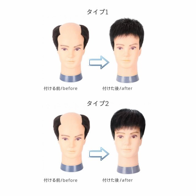 かつら メンズ ウィッグ 自然 セルフ増毛 人毛 部分ウィッグ 男性 薄毛